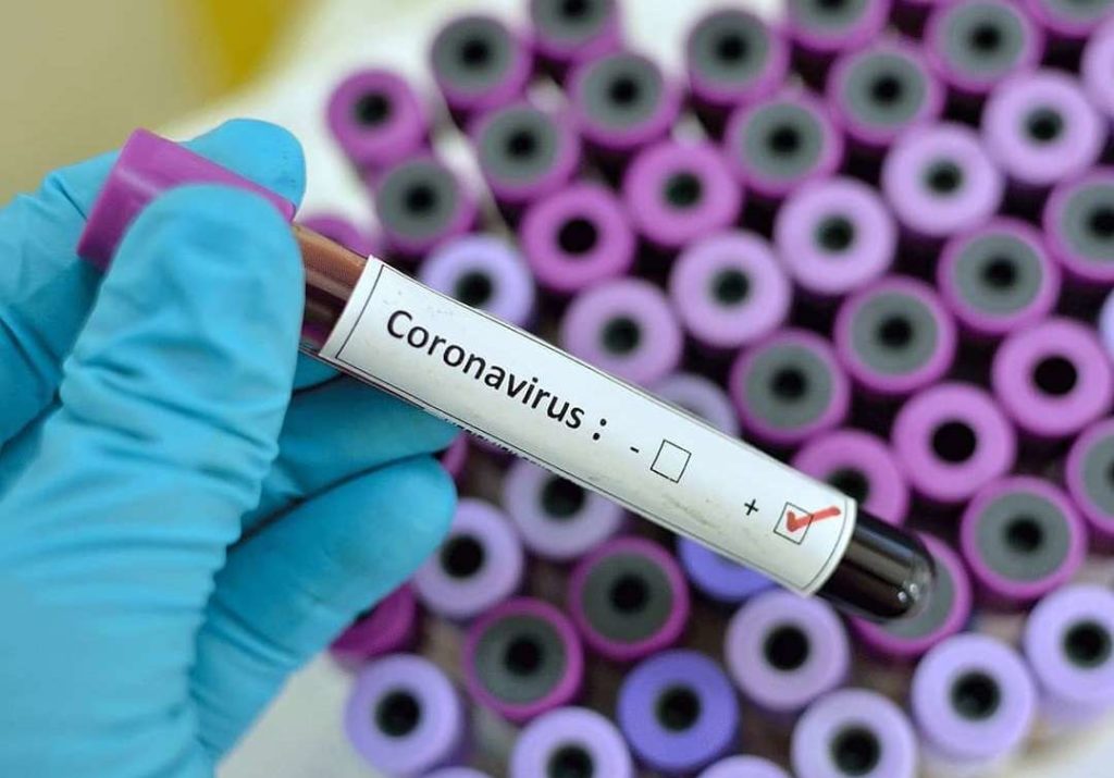 coronavirus-test