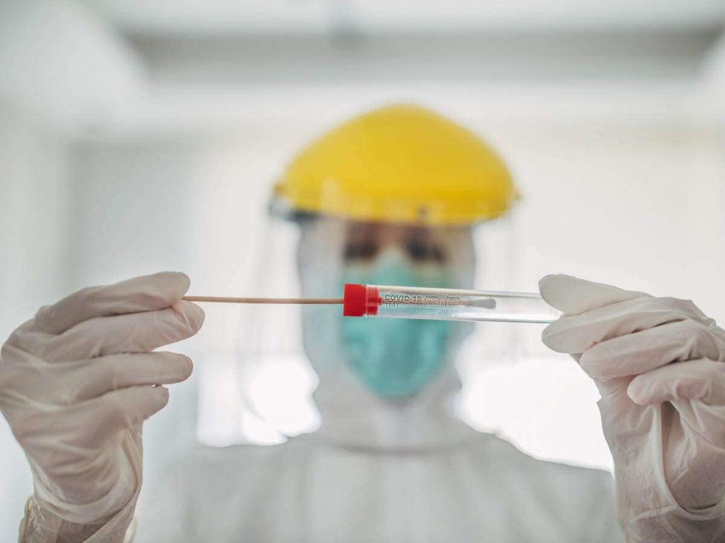stopcovid-test-works-on-samples-taken-using-the-less-invasive-anterior-nasal-swab-