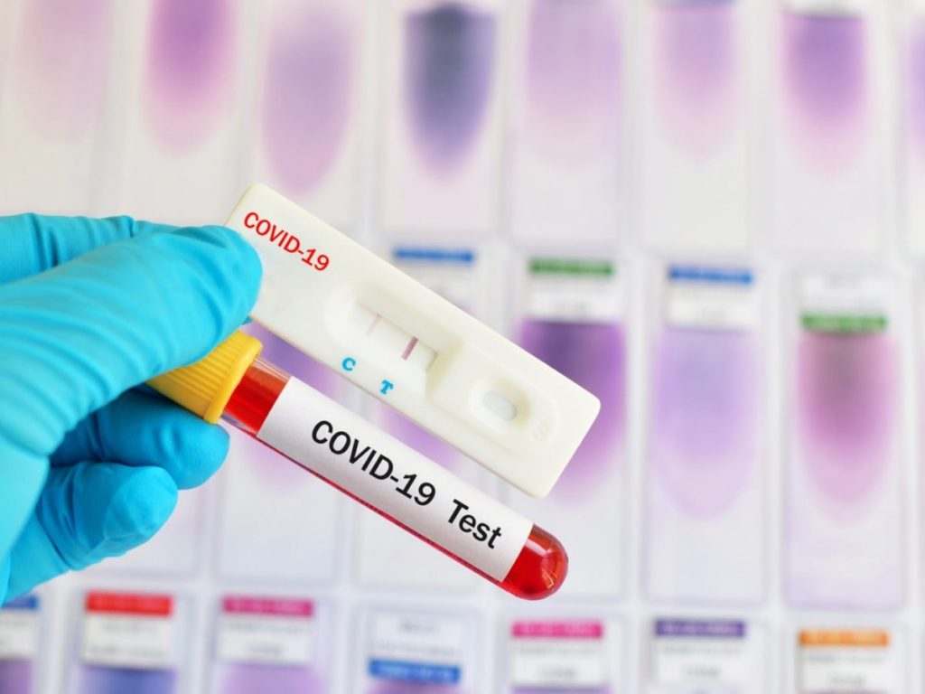 Ι.Σ.Α.: 25.000 rapid tests διενεργήθησαν τον Μάρτιο και τον Απρίλιο