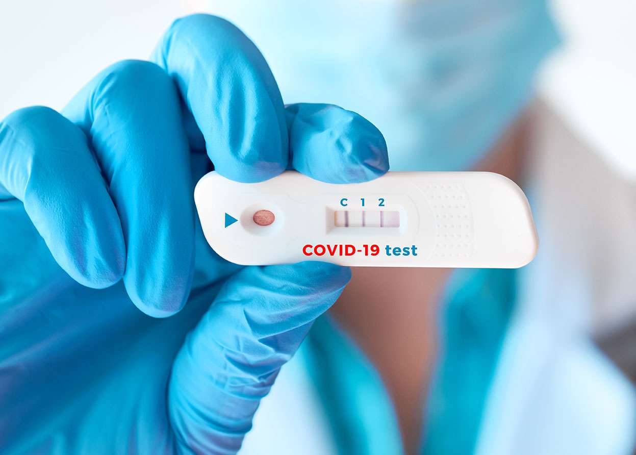 doctor-shows-rapid-laboratory-covid-19-test-detection-igm-igg-antibodies-novel-coronavirus-sars-cov-2