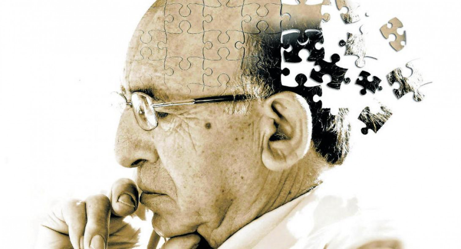Ο FDA έδωσε έγκριση σε νέο φάρμακο για το Αλτσχάιμερ
