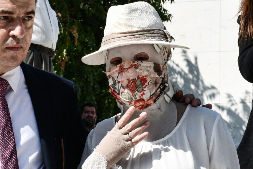 ΔΙΚΗ ΤΗΣ 37ΧΡΟΝΗΣ ΓΙΑ ΤΗΝ ΕΠΙΘΕΣΗ ΜΕ ΒΙΤΡΙΟΛΙ (EUROKINISS/ΤΑΤΙΑΝΑ ΜΠΟΛΑΡΗ)