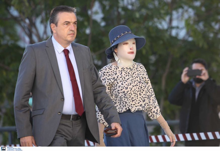 Δίκη για την επίθεση με βιτριόλι: «Μια κουταλιά βιτριόλι μπορεί να σκοτώσει»
