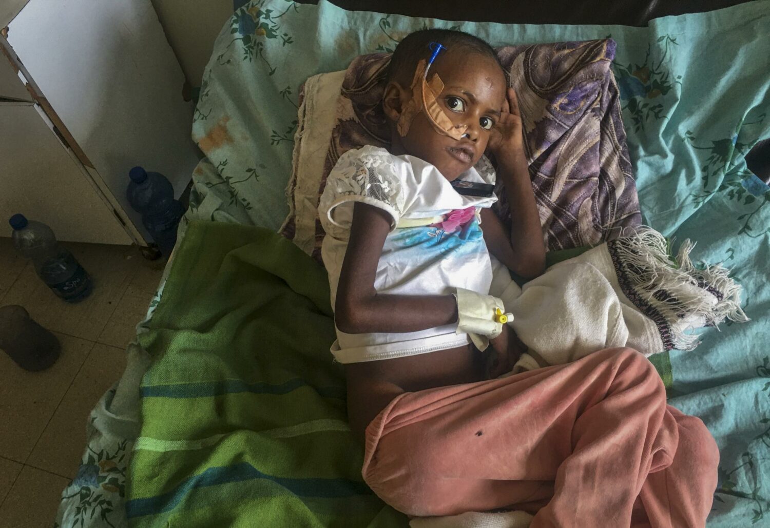 Αιθιοπία: Σχεδόν 200 παιδιά έχουν πεθάνει από την πείνα σε νοσοκομεία του Τιγκράι