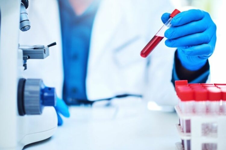 Νέο τεστ αίματος ανιχνεύει τον καρκίνο πριν εμφανιστούν κύρια συμπτώματα