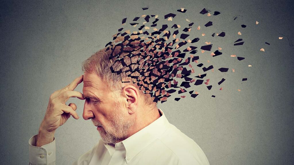 Memory loss due to dementia. Senior man losing parts of head  as symbol of decreased mind function.