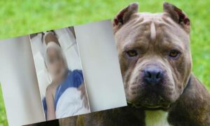 Θεσσαλονίκη: Σκυλιά επιτέθηκαν σε γυναίκες με συνέπεια να καταλήξουν στο νοσοκομείο