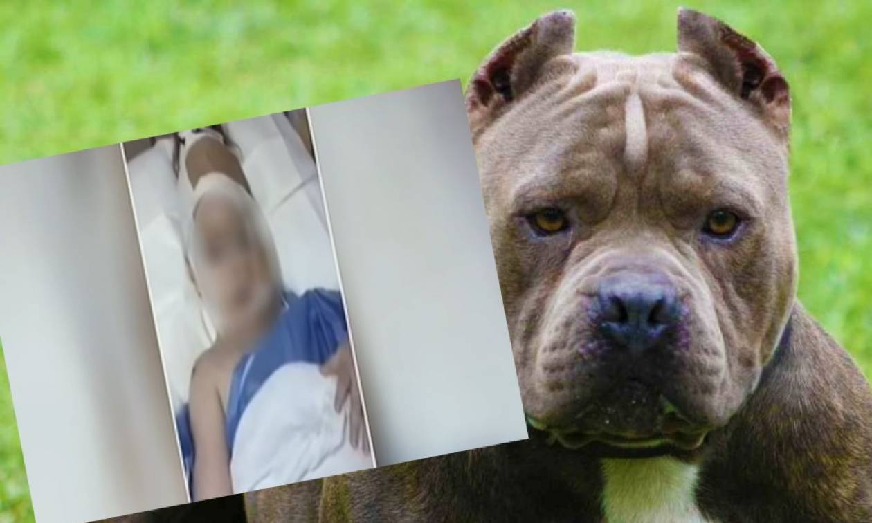 Θεσσαλονίκη: Σκυλιά επιτέθηκαν σε γυναίκες με συνέπεια να καταλήξουν στο νοσοκομείο