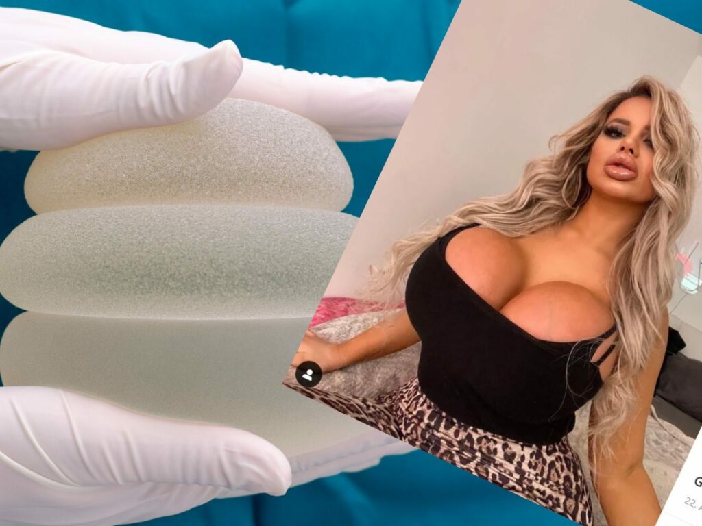 21χρονη ξόδεψε 65.000 ευρώ για να γίνει σαν την.. Barbie!