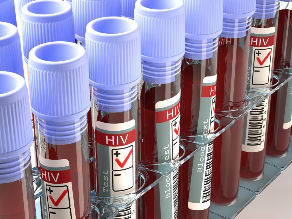Κυριακίδου: Το 17,6% από τα 601 νέα κρούσματα του HIV στην Ελλάδα από ενδοφλέβια ναρκωτικά