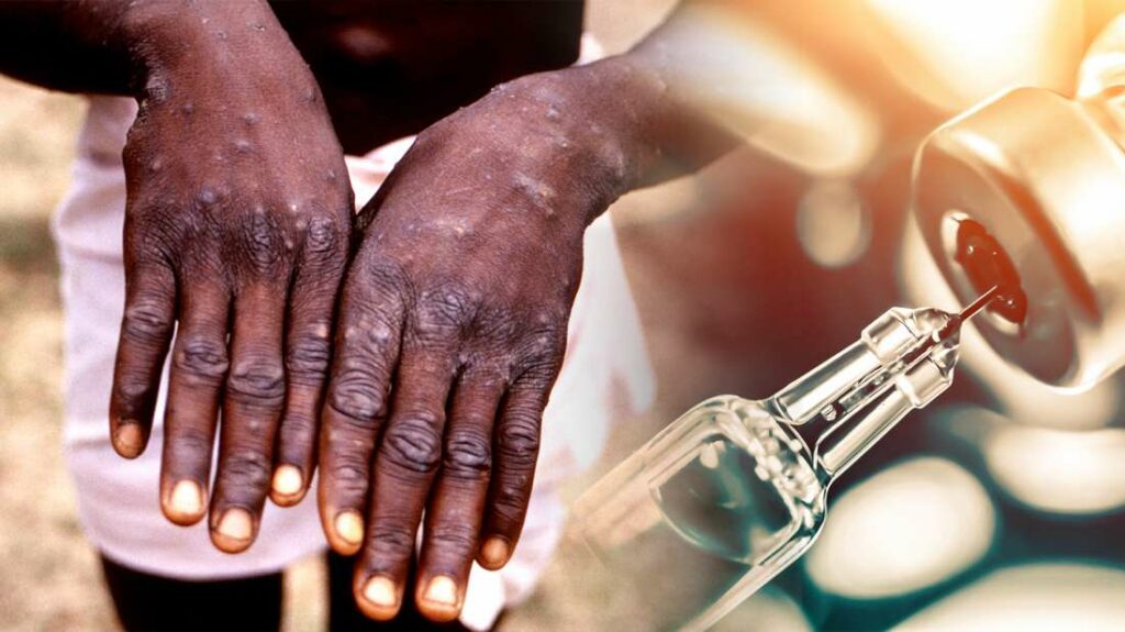 220730200342_eylogia pithikon-monkeypox-embolio