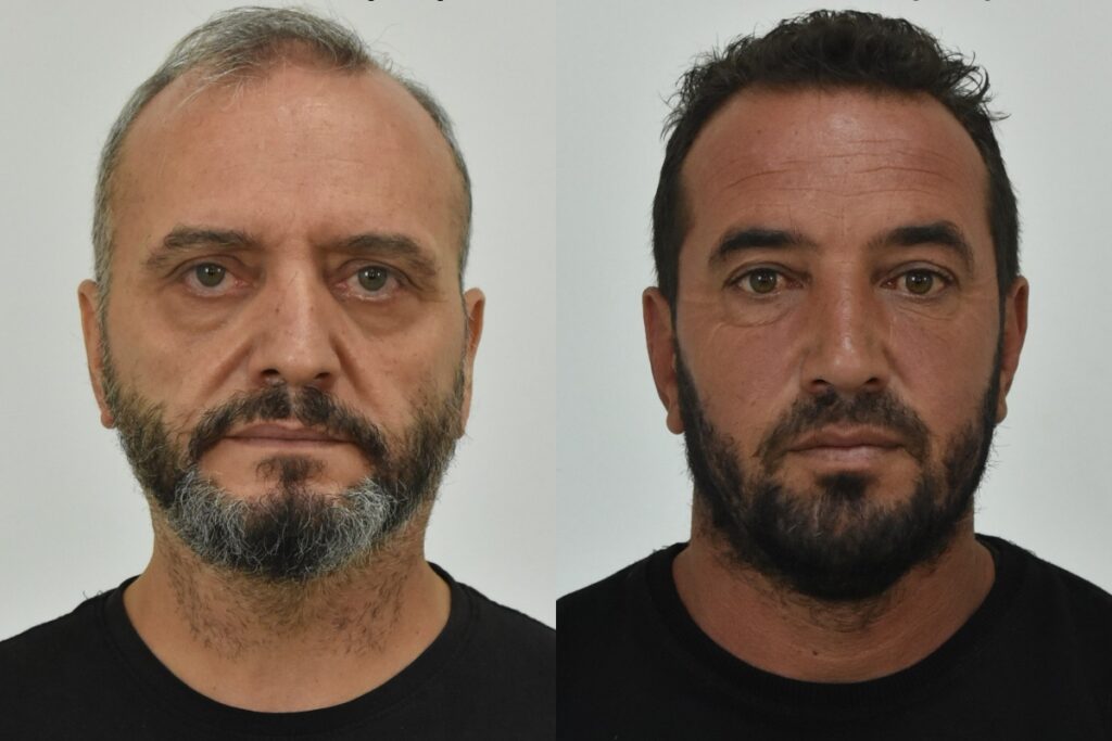 Σεπόλια: Στις φυλακές Τρικάλων οι κατηγορούμενοι βιαστές της 12χρονης