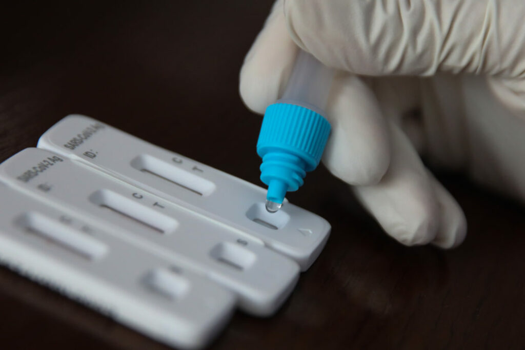 ΕΟΔΥ: Πού μπορείτε να κάνετε δωρεάν rapid test αύριο Δευτέρα 23/10
