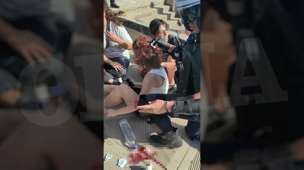 Πολυτεχνειούπολη: Αστυνομικοί παρέχουν τις πρώτες βοήθειες στη φοιτήτρια που τραυματίστηκε 