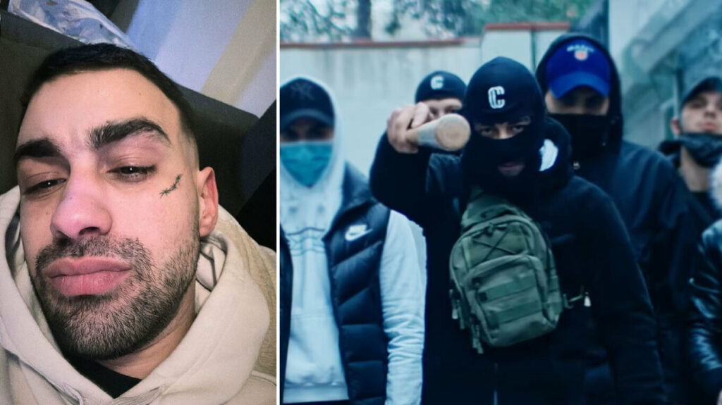 Θεσσαλονίκη: Τράπερ ξυλοκόπησε φοιτητή κι αναζητείται - Στη ΜΕΘ ο 23χρονος