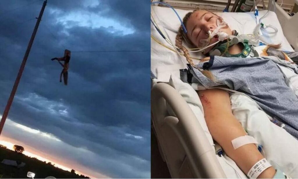 Φρικτό τροχαίο στις ΗΠΑ: Kρεμόταν μία ώρα σε καλώδιο ηλεκτροδότησης από το σπασμένο πόδι της