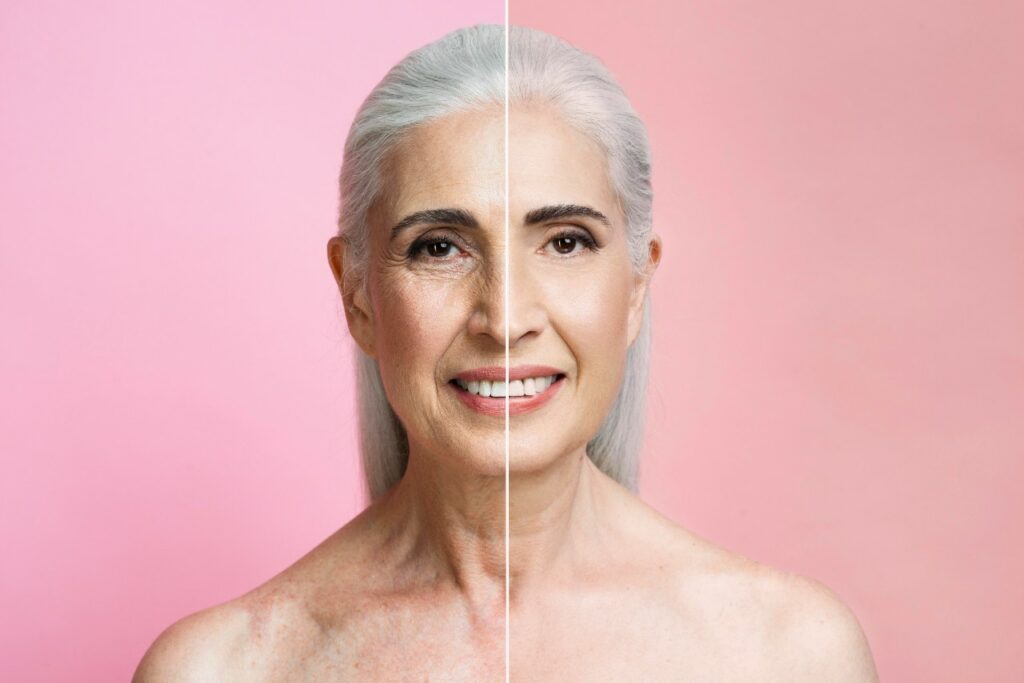 240516151638_botox