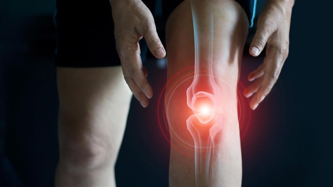 Πόνος στο γόνατο; Πότε χρειάζεται αρθροπλαστική;