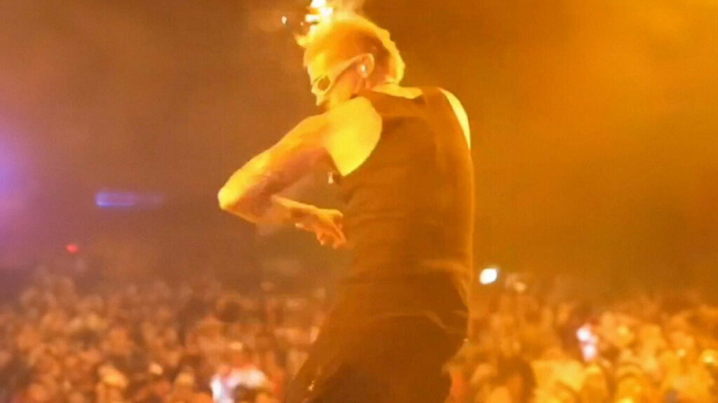 Κολομβία: Τρόμος για τραγουδιστή όταν έπιασαν φωτιά τα μαλλιά του σε συναυλία