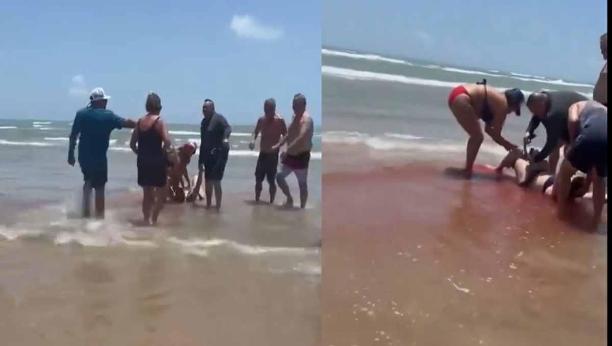 Τέξας: Τρόμος σε παραλία, καρχαρίας επιτέθηκε και τραυμάτισε τέσσερα άτομα