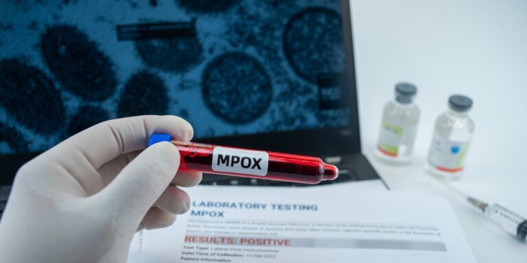 Τεστ για ιό mpox