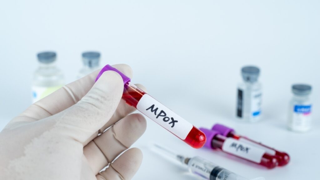 Mpox: Το νέο στέλεχος αλλάζει γρήγορα -«Δουλεύουμε στα τυφλά για να το αντιμετωπίσουμε», λένε οι επιστήμονες