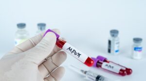 Mpox: Το νέο στέλεχος αλλάζει γρήγορα -«Δουλεύουμε στα τυφλά για να το αντιμετωπίσουμε», λένε οι επιστήμονες