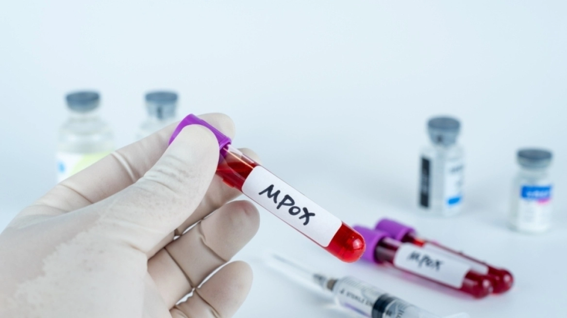 Κίνα: 5 κρούσματα της παραλλαγής clade 1b του mpox