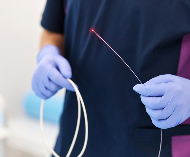 Ενδοαυλική θεραπεία με laser: Αντιμετώπιση κιρσών και φλεβικής ανεπάρκειας