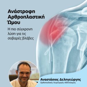 Διαβάστε ακόμη: • Μερίσματα: Θα σπάσουν το φράγμα των 5 δισ. ευρώ οι εισηγμένες • Ελένη Φουρέιρα: Πόζαρε μόνο με το μπουρνούζι της στον καθρέφτη του μπάνιου • Αxios: Αυτή είναι η τελική πρόταση Τραμπ για να λήξει ο πόλεμος στην Ουκρανία • Eurostat: Ποιες χώρες μείωσαν περισσότερο το χρέος – Πρωταθλήτρια η Ελλάδα
