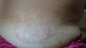 Χανιά: Θαλάσσια χελώνα δάγκωσε γυναίκα στο Μαράθι - Φωτογραφίες
