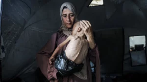The Lancet: Σχεδόν το ένα παιδί στα έξι υφίσταται ακραίο οξύ υποσιτισμό στη Γάζα