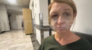 Κορωπί: “Θα την πάρω πίσω στη Λιθουανία” – Τι λέει η μητέρα της 40χρονης που ξυλοκοπήθηκε από τον σύντροφό της