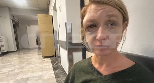 Κορωπί: «Δεν θυμάμαι ποιος με χτύπησε» – Eπιμένει η 40χρονη που έπεσε θύμα ξυλοδαρμού από τον σύντροφό της