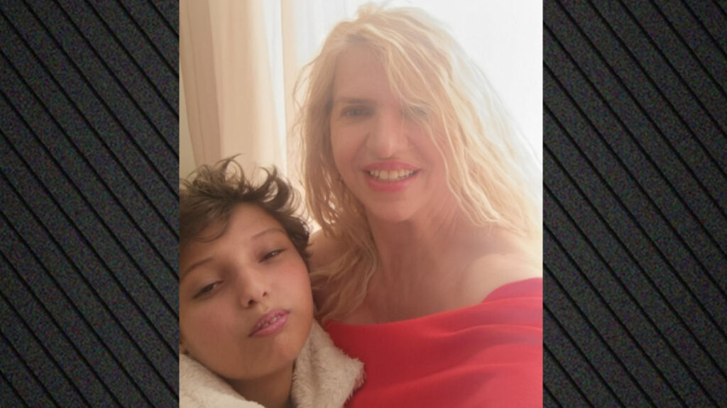 O 18χρονος Μάριος από το Αγρίνιο, με το σπάνιο σύνδρομο Alagille, συνεχίζει στο Τορίνο τον αγώνα για τη ζωή του