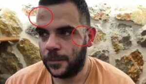 Επίθεση στον YouTuber Teosty στα Ιωάννινα: Του είχαν πετάξει και αυγά πριν τον άγριο ξυλοδαρμό - Το χρονικό