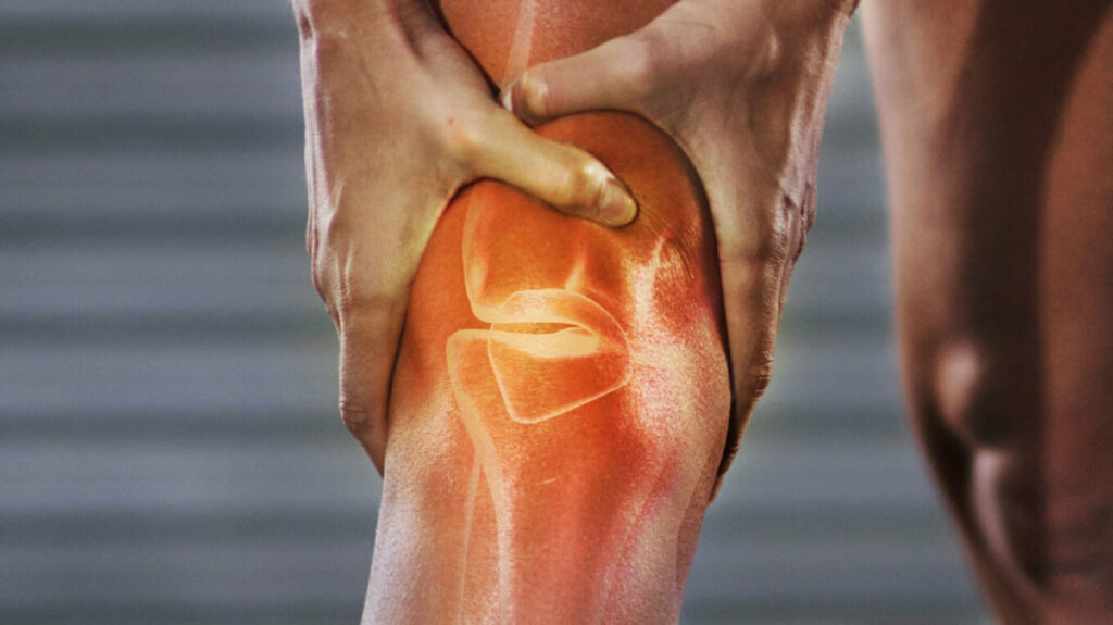 Αθλητές: Συχνές κακώσεις γόνατος και εξατομικευμένη χειρουργική αντιμετώπιση