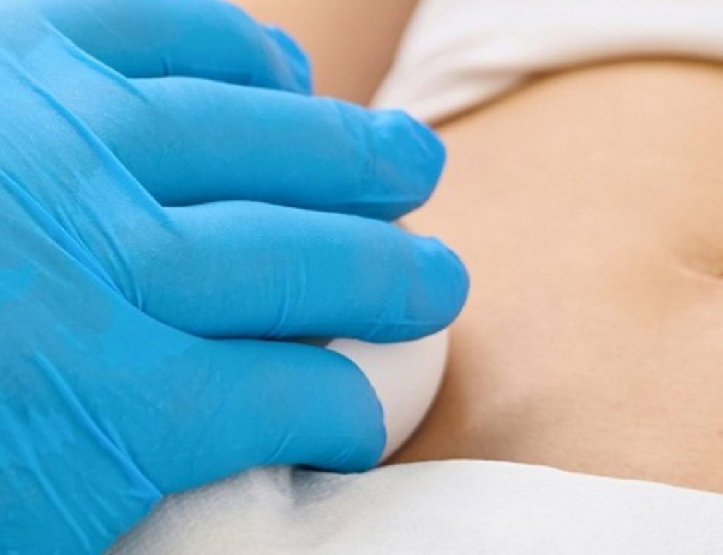 260316144419_aneurisma_arthrou