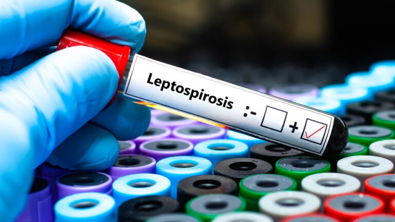 Tρία κρούσματα λεπτοσπείρωσης στη Ζάκυνθο, νεκρός 74χρονος