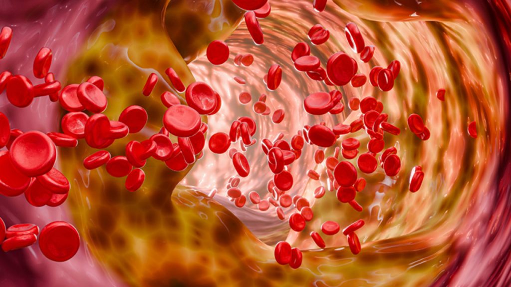 Περιφερική αρτηριοπάθεια: Διάγνωση και σύγχρονες θεραπευτικές επιλογές