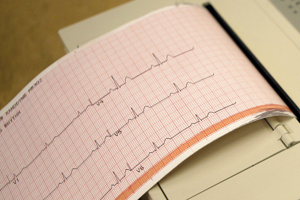 New Heart Drugs